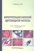 Интерпретация биопсий щитовидной железы