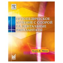 Ортопедическое лечение с опорой на дентальные имплантаты