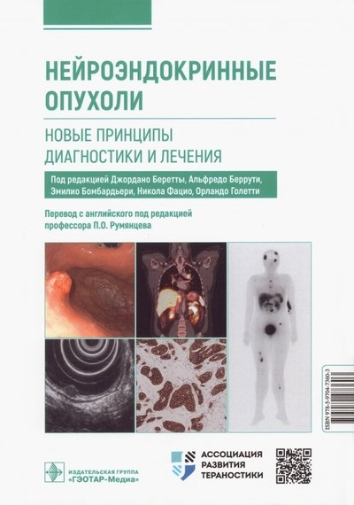 Атласы анатомии. Медико-биологические дисциплины Нейроэндокринные опухоли. Новые принципы диагностики и лечения. Руководство для врачей