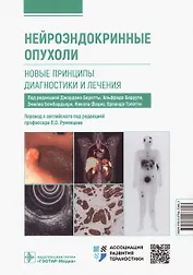 Нейроэндокринные опухоли. Новые принципы диагностики и лечения. Руководство для врачей