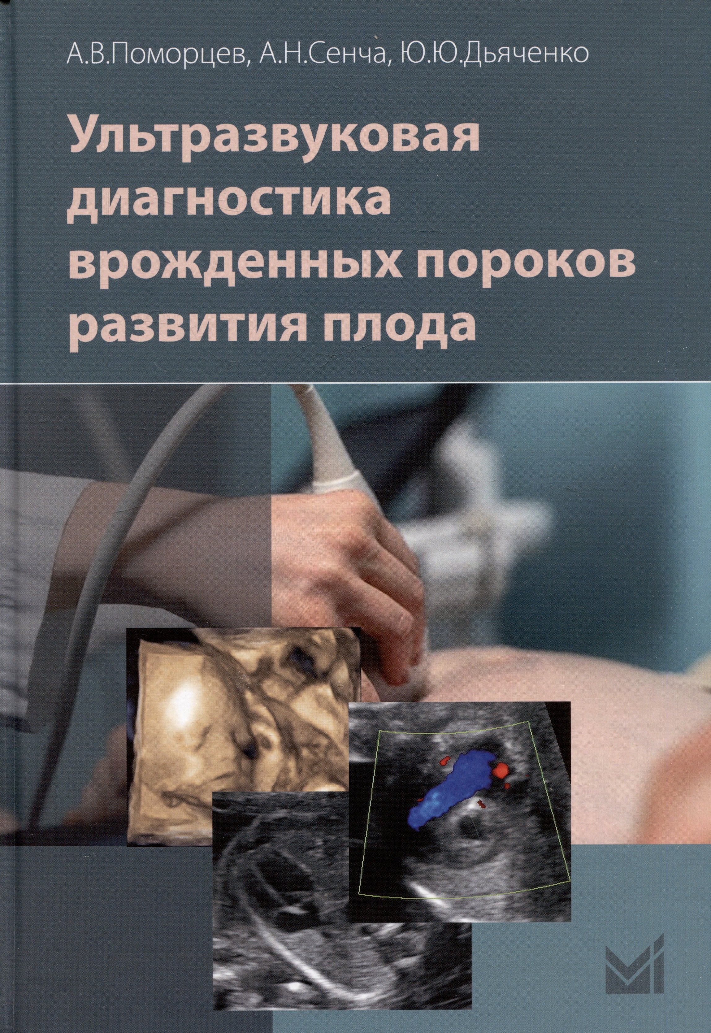 

Ультразвуковая диагностика врожденных пороков развития плода