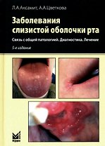 Заболевания слизистой оболочки рта. Связь с общей патологией. Диагностика. Лечение