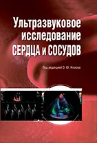 Ультразвуковое исследование сердца и сосудов