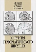 Хирургия геморрагического инсульта