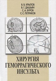 Хирургия геморрагического инсульта