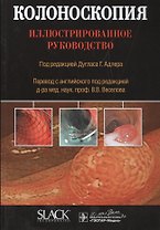 Колоноскопия