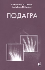 Подагра
