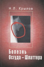 Болезнь Осгуда - Шлаттера