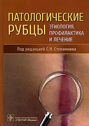 Патологические рубцы. Этиология, профилактика и лечение