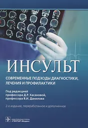 Инсульт. Современные подходы диагностики, лечения и профилактики. Методические рекомендации