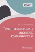 Телеангиэктазии нижних конечностей - 0