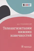 Телеангиэктазии нижних конечностей