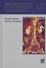 Спиральная и многослойная компьютерная томография. Том 1. Учебное пособие