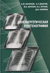 Двухэнергетическая рентгенография