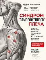 Синдром "замороженного" плеча. Терапия триггерных точек для преодоления боли и восстановления диапазона движений