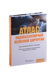 Атлас эндоваскулярной венозной хирургии