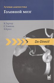 Лучевая диагностика. Головной мозг