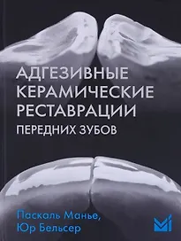 Адгезивные керамические реставрации передних зубов