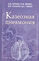 Казеозная пневмония. Руководство для врачей