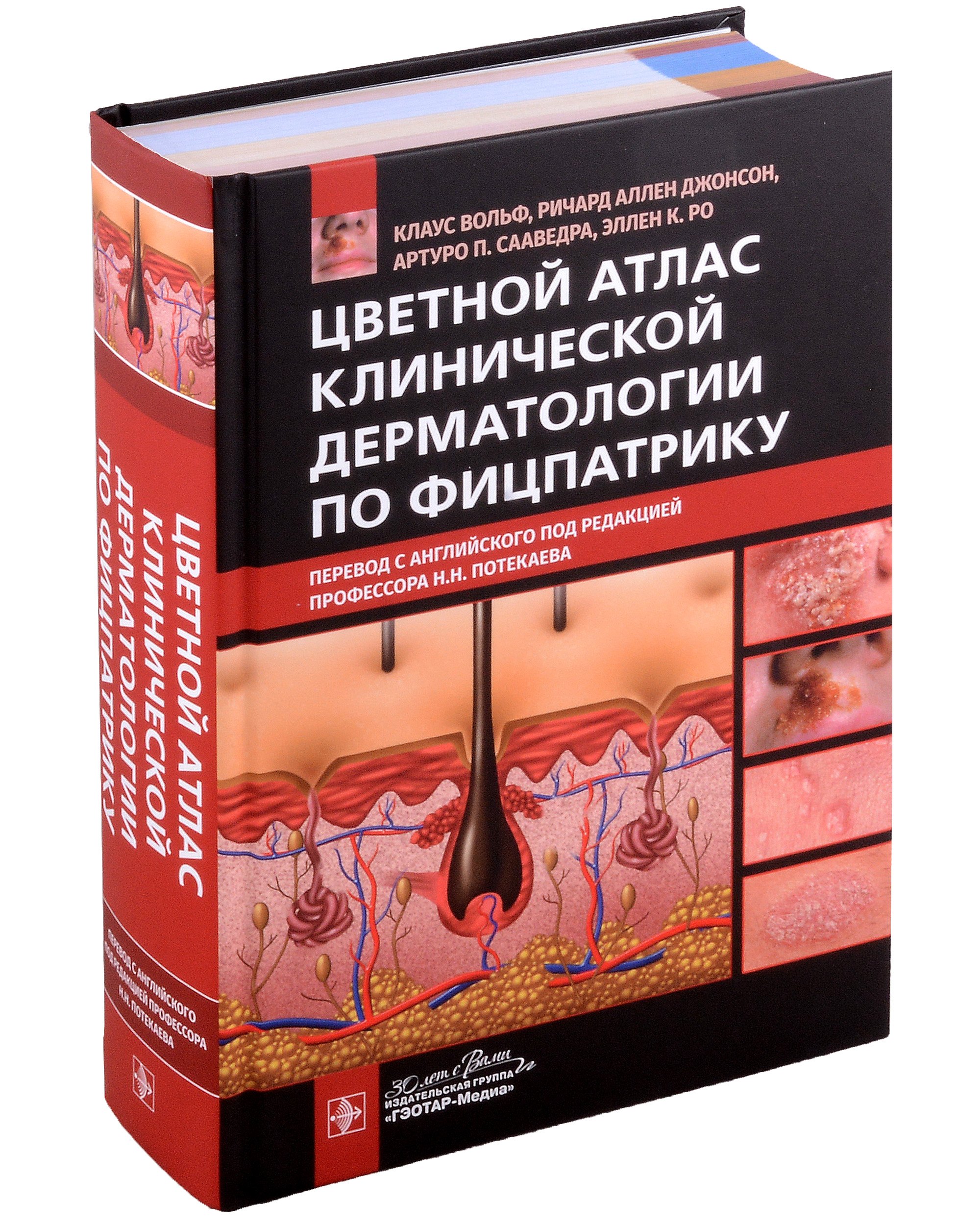 

Цветной атлас клинической дерматологии по Фицпатрику