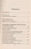 Пиявка ваш домашний доктор: Гирудотерапия для разных типов людей - 1