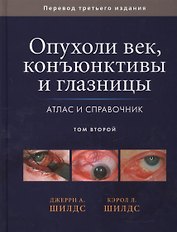 Опухоли век, конъюктивы и глазницы. Атлас и справочник т.2