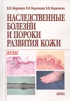 Наследственные болезни и пороки развития кожи. Клиника. Морфология. Лечение. Атлас
