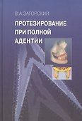 Протезирование при полной адентии. - 0