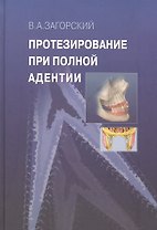 Протезирование при полной адентии.