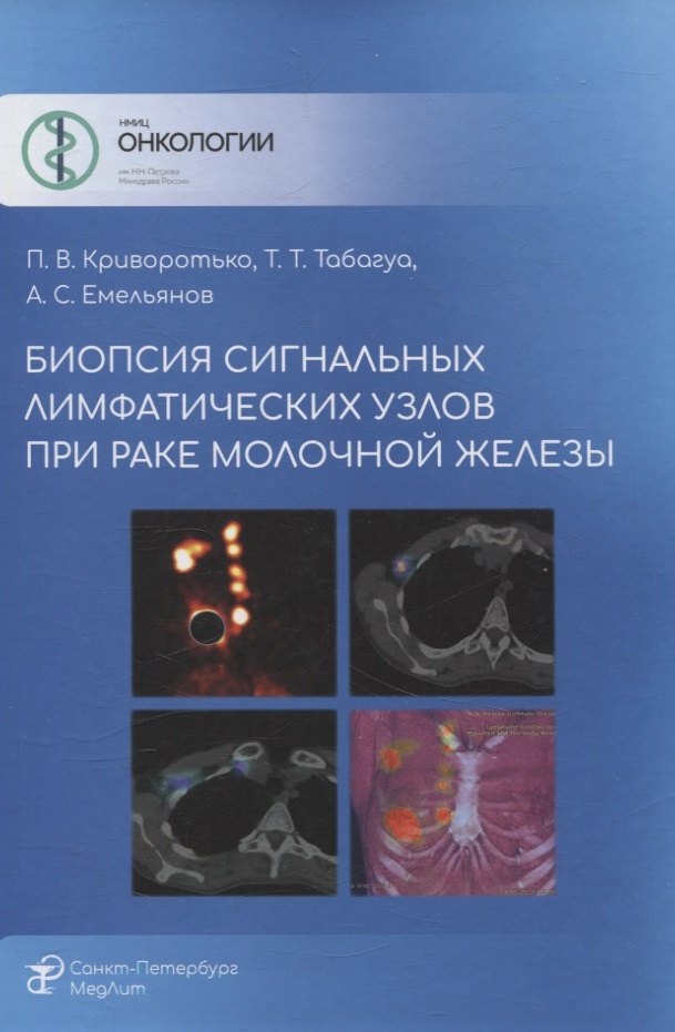 

Биопсия сигнальных лимфатических узлов при раке молочной железы