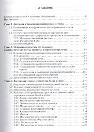 Боль в спине