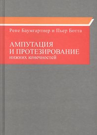 Ампутация и протезирование нижних конечностей