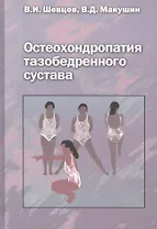 Остеохондропатия тазобедренного сустава. Руководство для врачей
