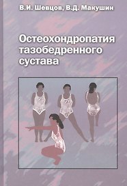 Остеохондропатия тазобедренного сустава. Руководство для врачей