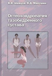 Остеохондропатия тазобедренного сустава. Руководство для врачей