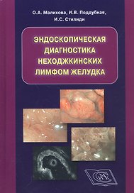 Эндоскопическая диагностика неходжкинских лимфом желудка