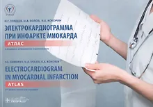 Электрокардиограмма при инфаркте миокарда: атлас на рус. и англ. яз. + вкладыш: линейка электрокардиографическая / 2-е изд., испр. и доп.