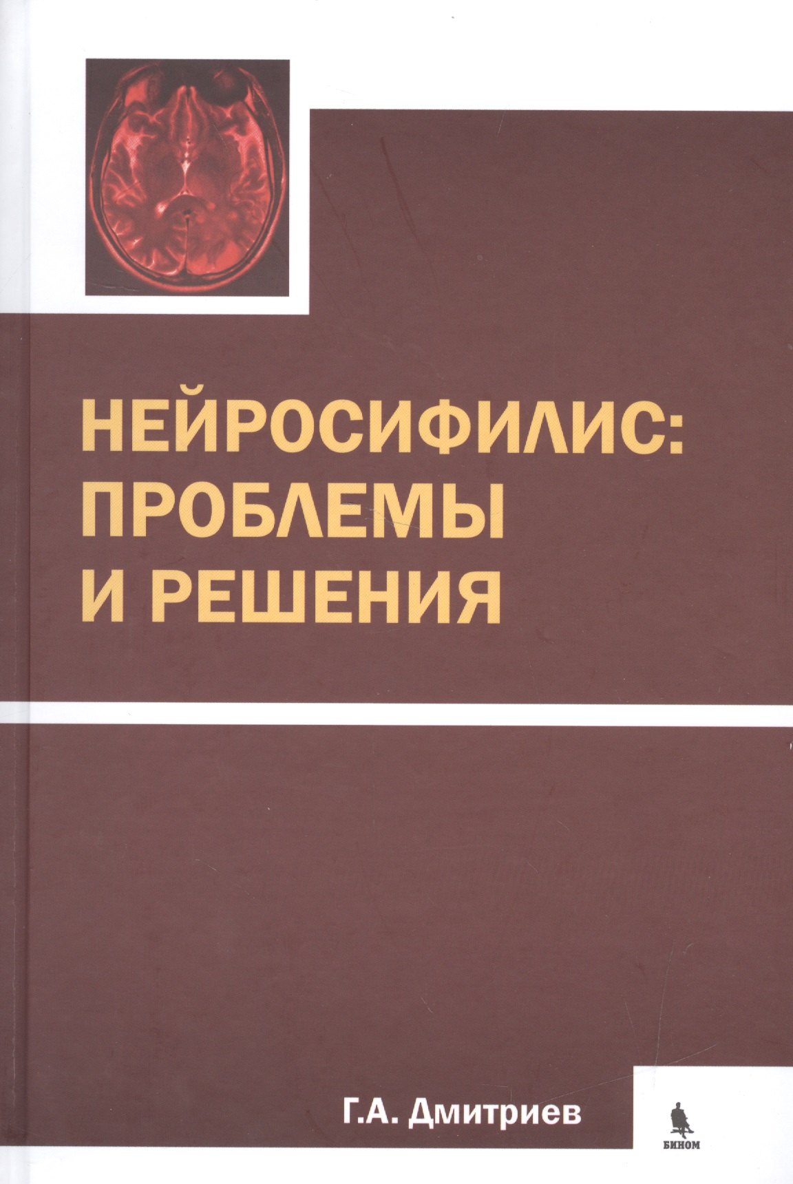 

Нейросифилис: проблемы и решения