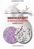 Миокардит в период пандемии SARS-CoV-2 - 0