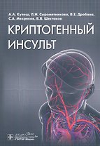 Криптогенный инсульт. Руководство