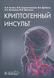 Криптогенный инсульт. Руководство