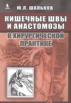 Кишечные швы и анастомозы в хирургической практике
