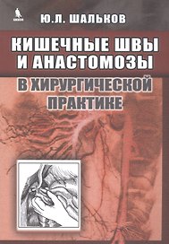 Кишечные швы и анастомозы в хирургической практике