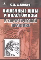 Кишечные швы и анастомозы в хирургической практике