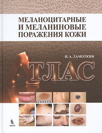 Меланоцитарные и меланиновые поражения кожи: учебное пособие