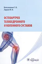 Остеоартроз тазобедренного и коленного суставов