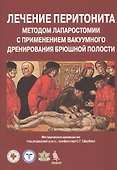 Лечение перитонита методом лапаростомии с применением вакуумного дренирования брюшной полости. Методическое руководство - 0