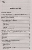 Лечение простатита народными методами - 1