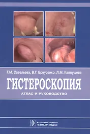 Гистероскопия : атлас и руководство. 2-е издание, дополненное и переработанное