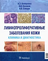 Лимфопролиферативные заболевания кожи. Клиника и диагностика